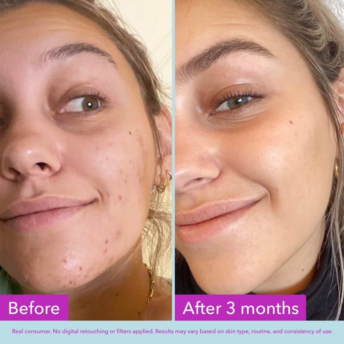 niacinamide-brightening-toner-a7 zb_p.jpg