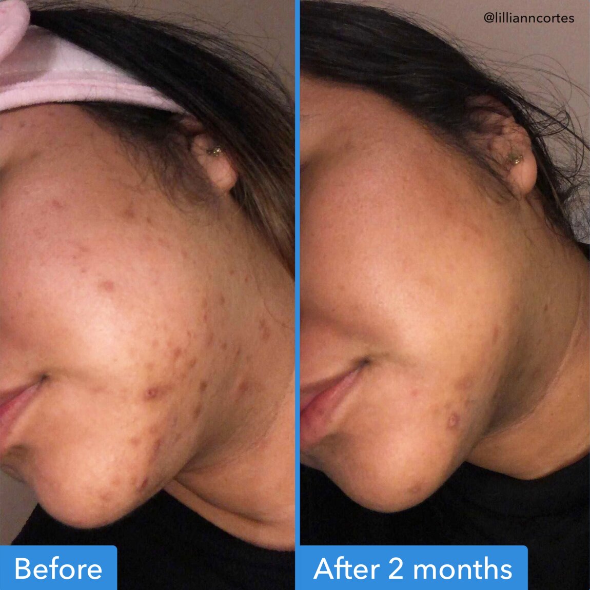 discoloration-correcting-serum-w0 zb_p.jpg